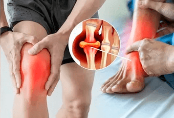 Schema fir d'Applikatioun vum Icexin Gel op d'Gebitt vum Kniegelenk a Fouss